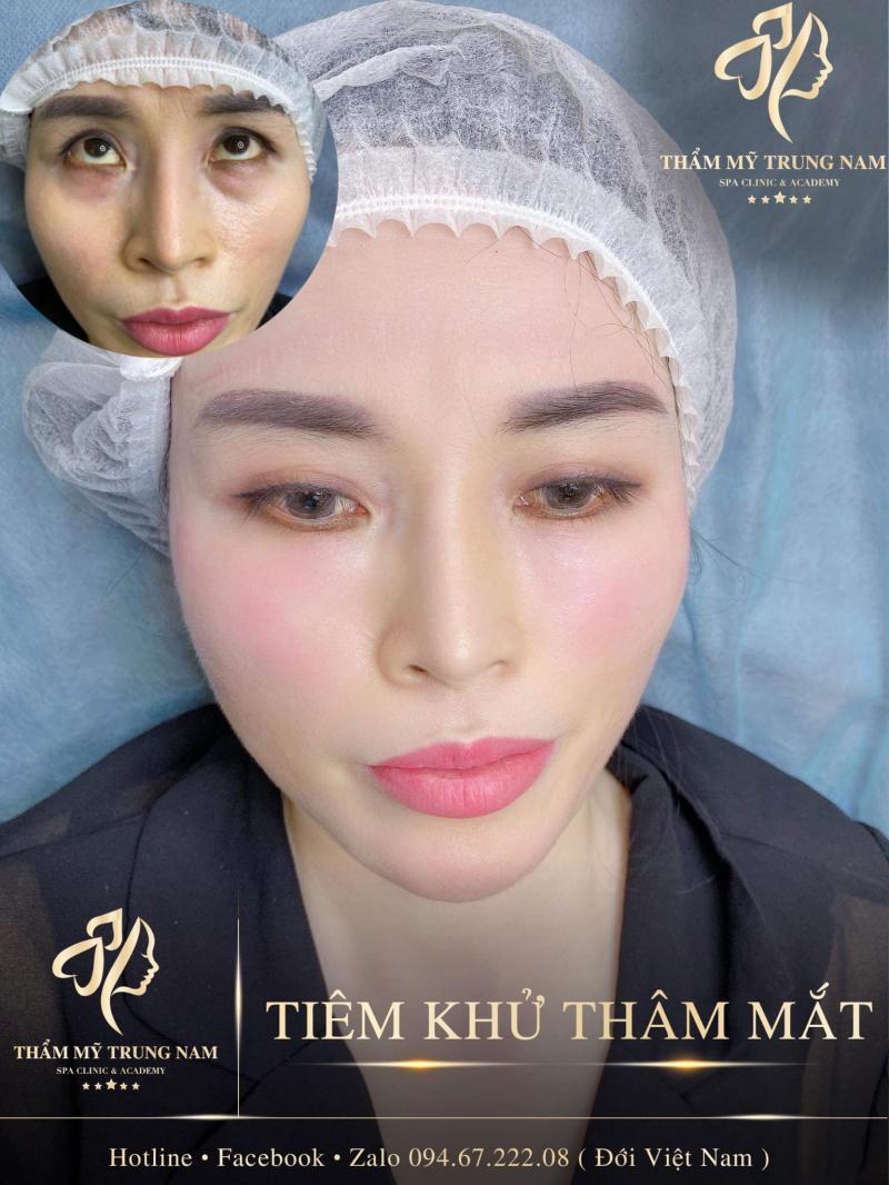 Thẩm Mỹ Trung Nam