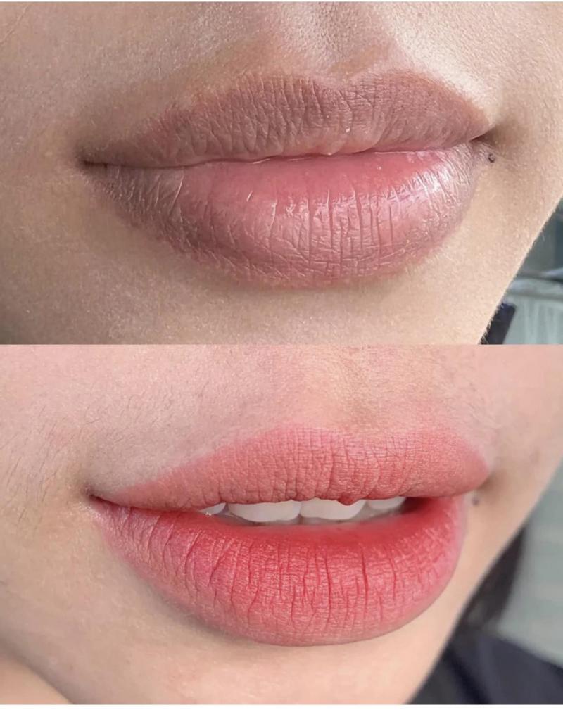 Thẩm mỹ Tuyến Dung
