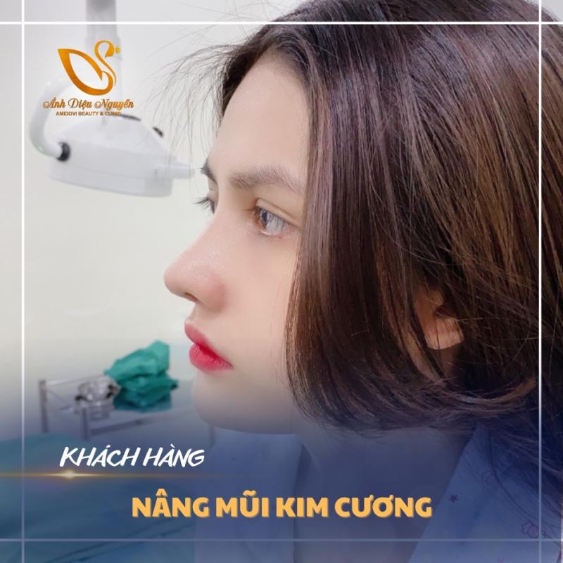 Thẩm Mỹ Viện Ánh Diệu Nguyễn
