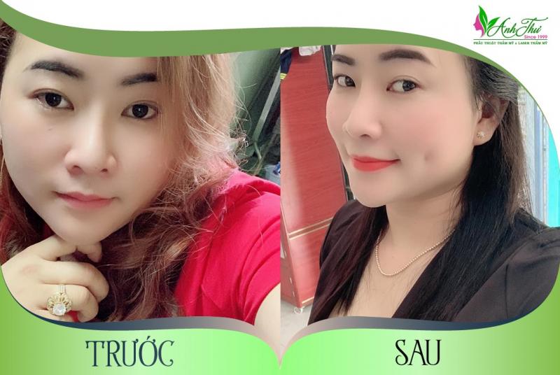 Thẩm mỹ viện Anh Thư