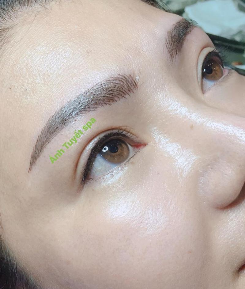 Thẩm Mỹ Viện Ánh Tuyết