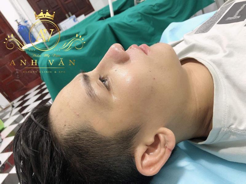 Thẩm Mỹ Viện ANH VĂN