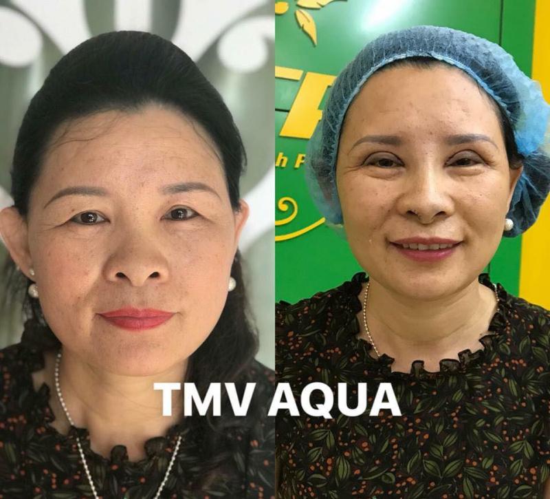 Thẩm Mỹ Viện AQUA