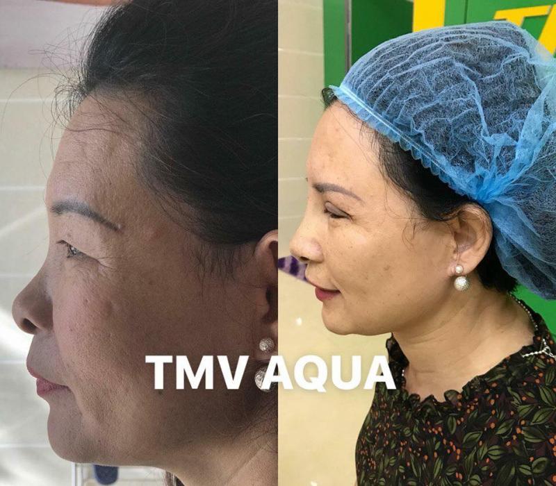 Thẩm Mỹ Viện AQUA