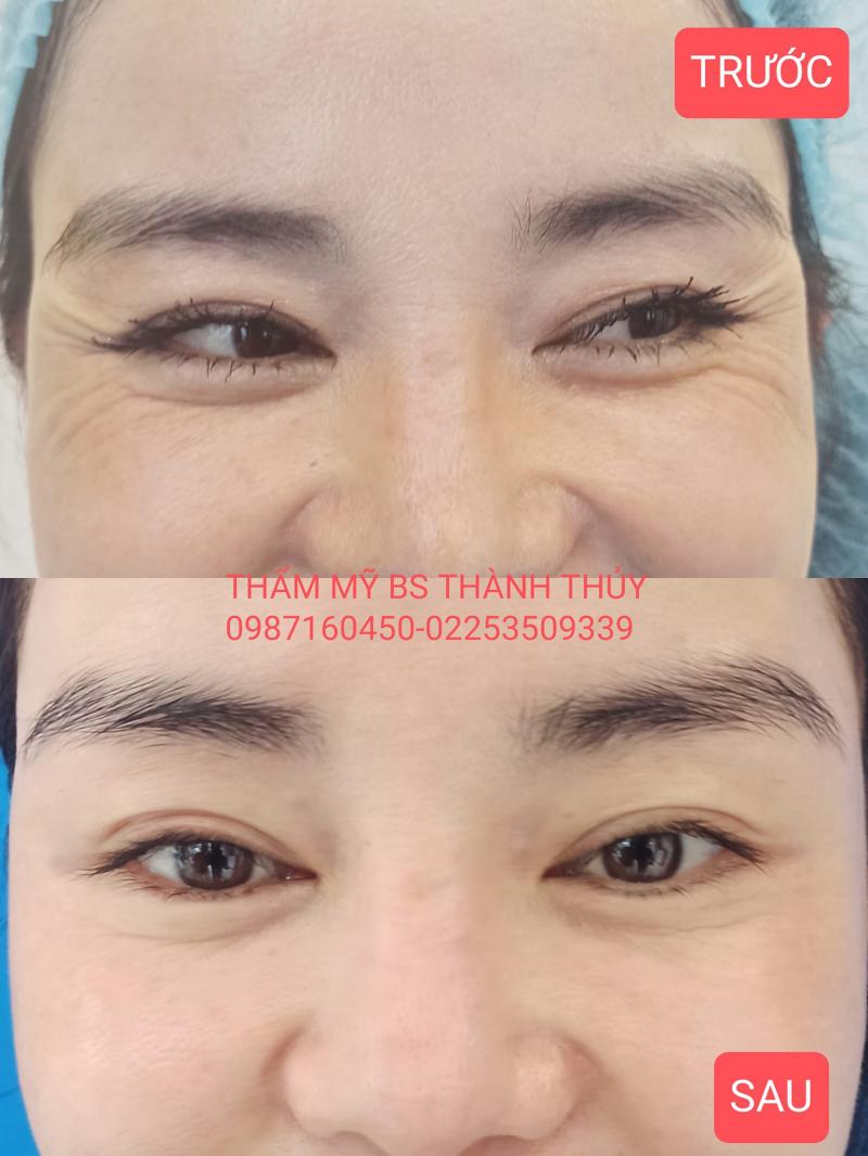 Thẩm mỹ viện Bác sỹ Thành Thủy