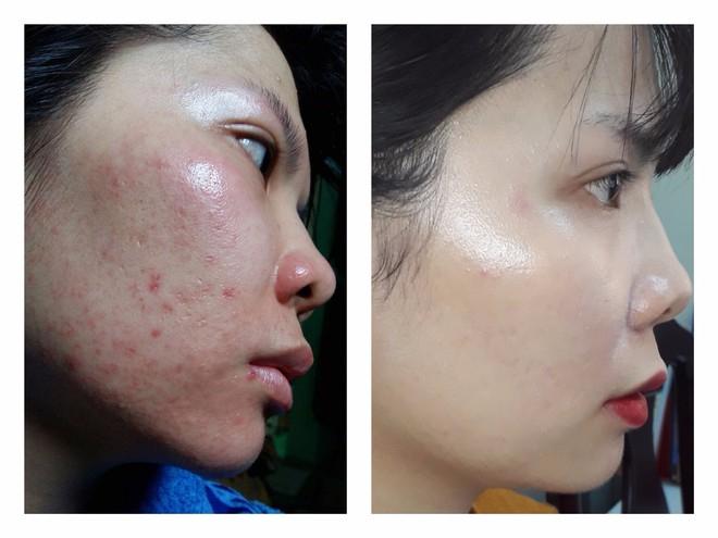 Thẩm mỹ viện Bảo Xinh