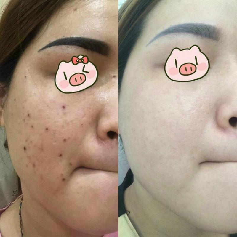 Thẩm Mỹ Viện BENA USA
