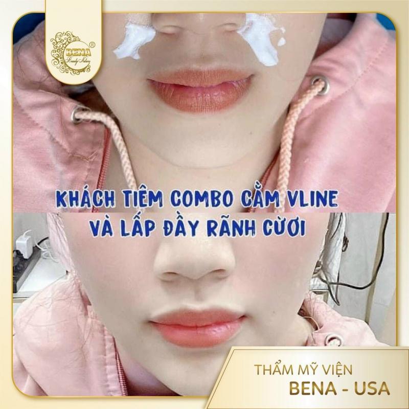 Thẩm Mỹ Viện Bena Usa