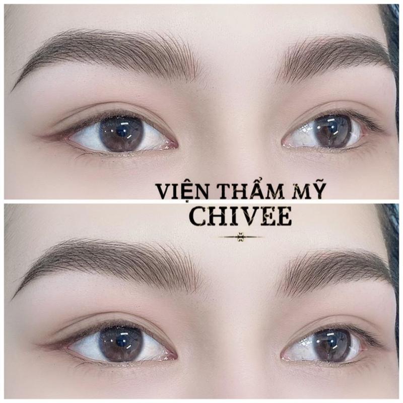 Viện Thẩm Mỹ CHIVEE