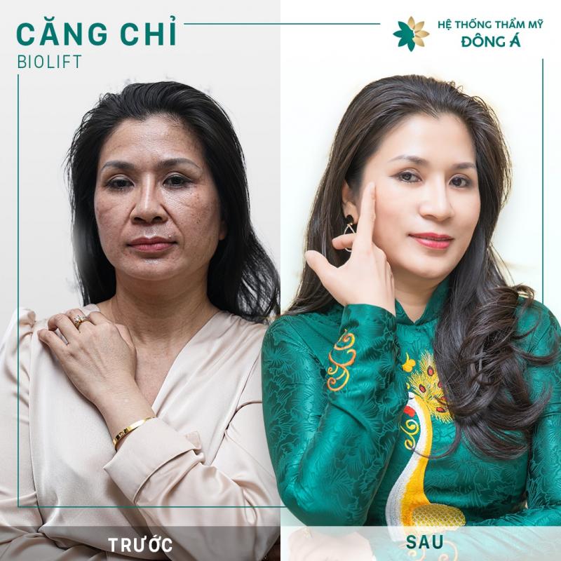 Bệnh viện thẩm mỹ Đông Á