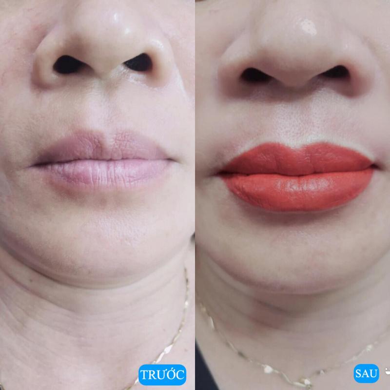 Thẩm Mỹ Viện Đông Á (Đà Nẵng)