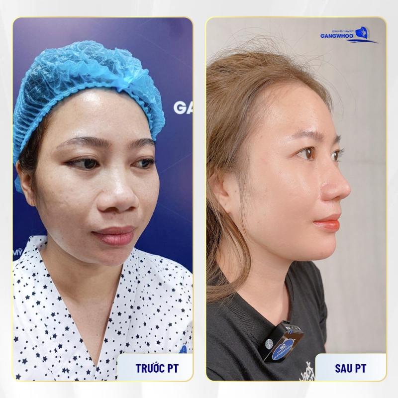 Thẩm mỹ viện GangWhoo Sài Gòn