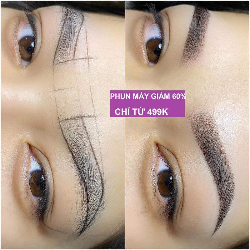 Thẩm Mỹ Viện Hoa Anh
