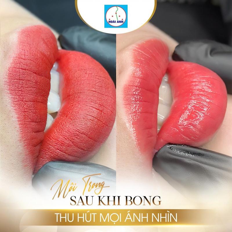 Thẩm Mỹ Viện Hoài Anh