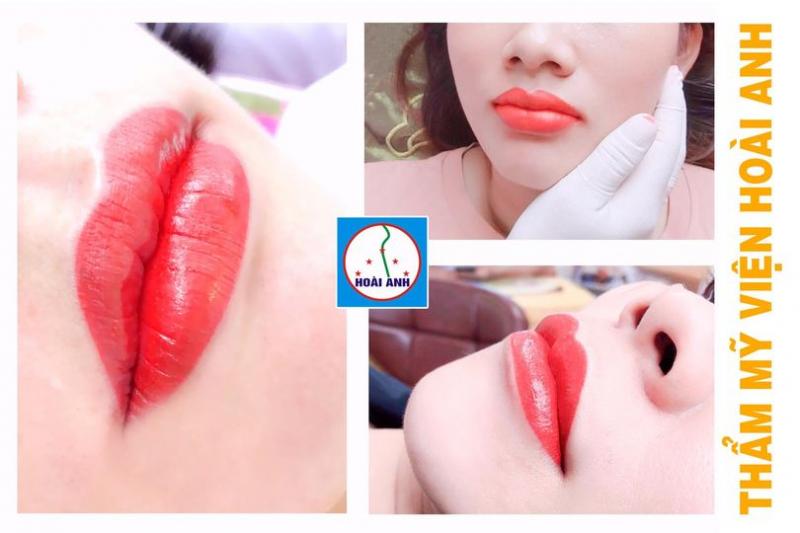 Thẩm mỹ viện Hoài Anh
