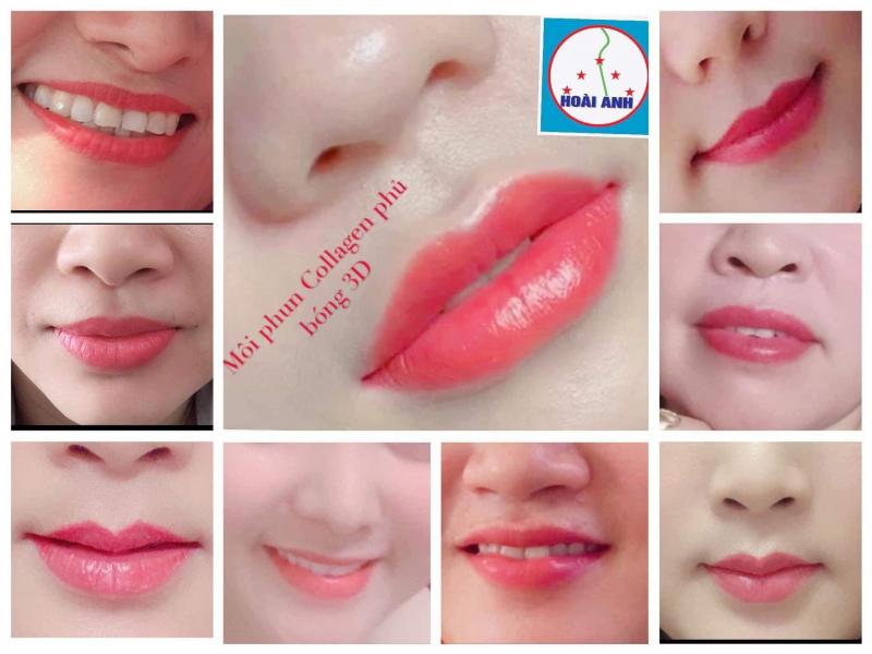 Thẩm mỹ viện Hoài Anh