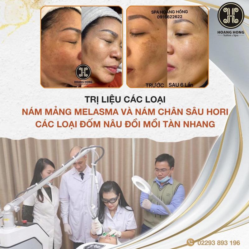 Thẩm Mỹ Viện Hoàng Hồng Ninh Bình