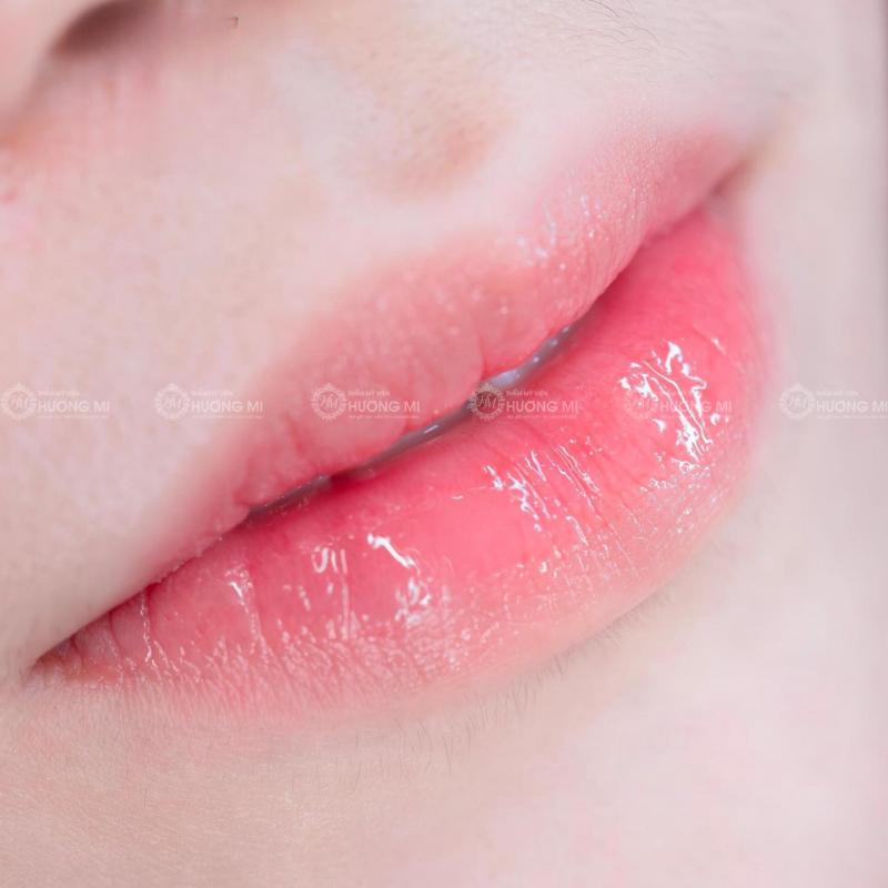 Thẩm mỹ viện Hương Mi