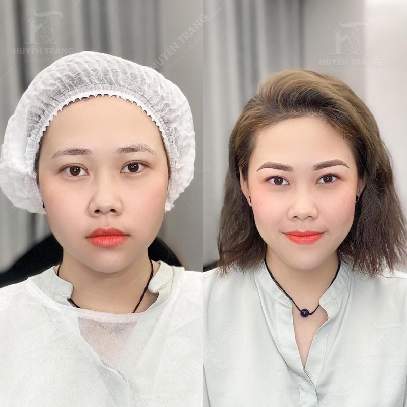 Viện Thẩm Mỹ Huyền Trang