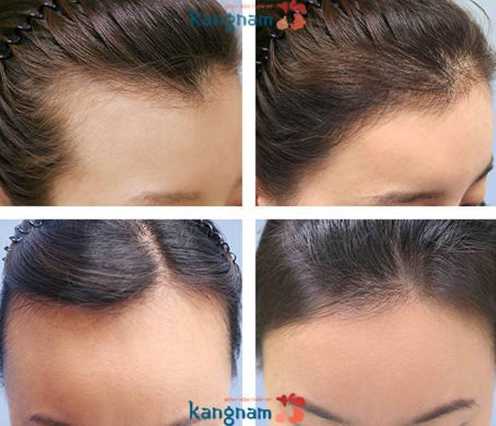 Bệnh viện thẩm mỹ Kangnam
