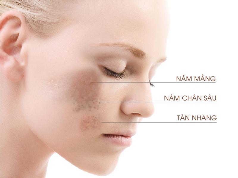 Thẩm Mỹ Viện Linh Châu