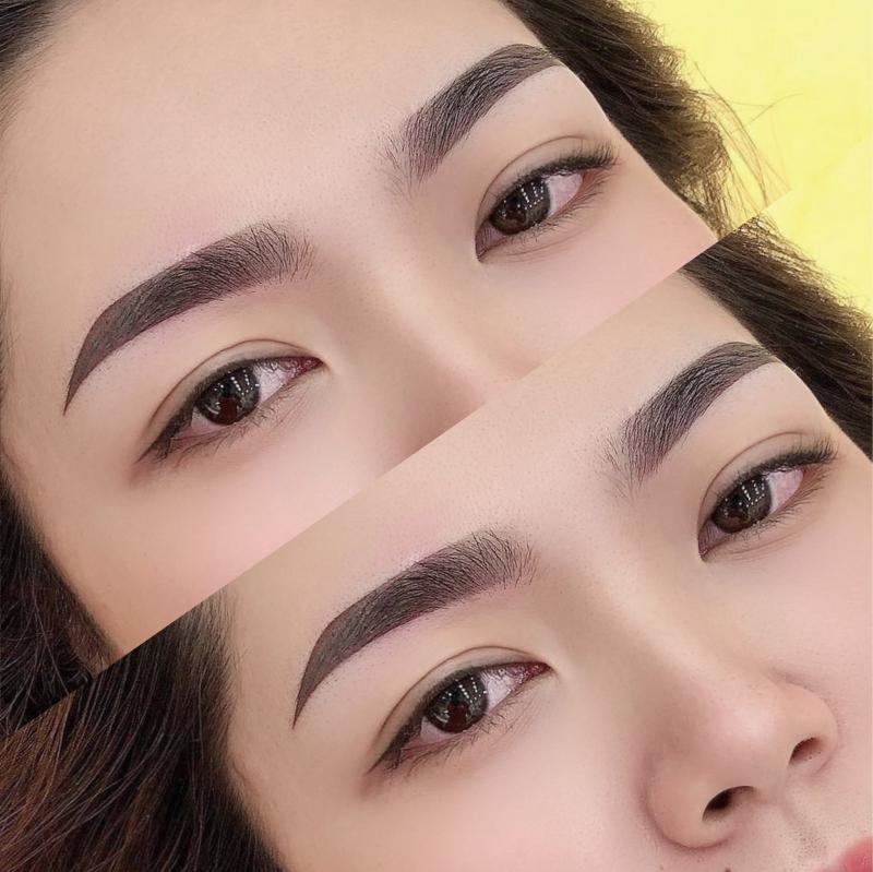 Thẩm Mỹ Viện LINH LAN ANH