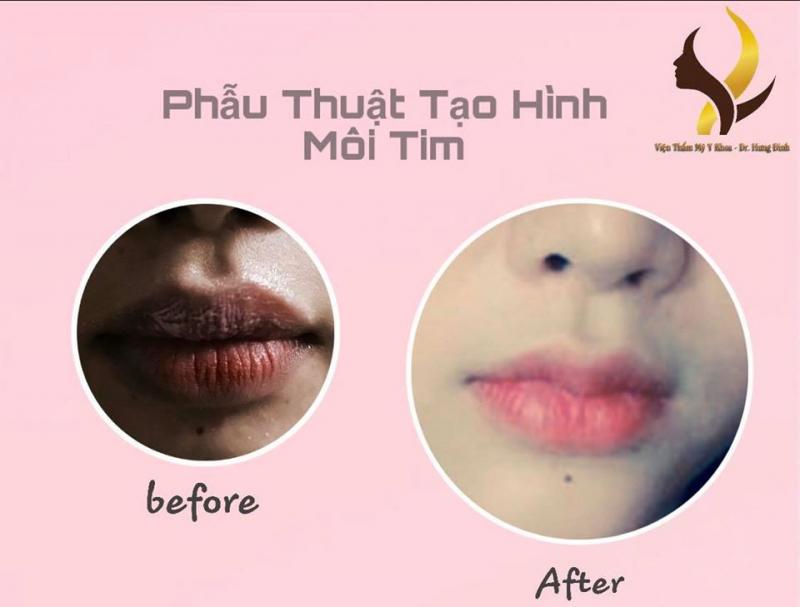 Thẩm mỹ viện Linh Linh Trang