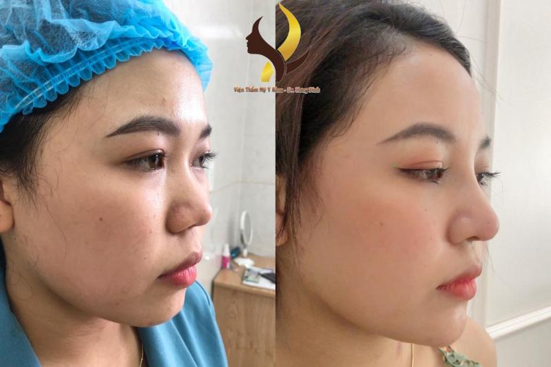 Thẩm Mỹ Viện Linh Linh Trang
