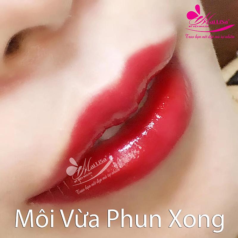 Thẩm Mỹ Viện Mailisa