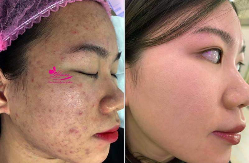 Thẩm mỹ viện Mailisa