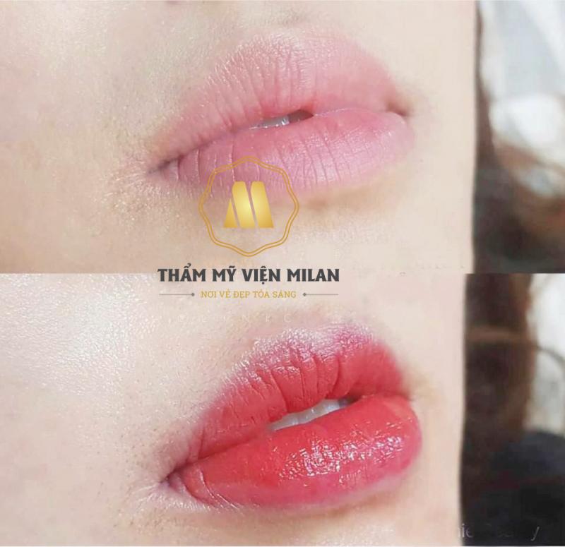 Thẩm Mỹ Viện Milan