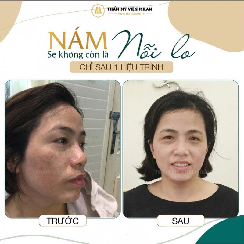 Thẩm mỹ viện Milan