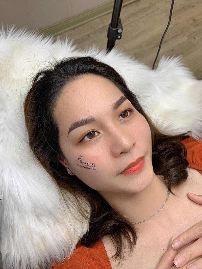 Thẩm Mỹ Viện Minh Tuyết