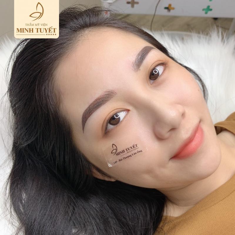 Thẩm Mỹ Viện Minh Tuyết