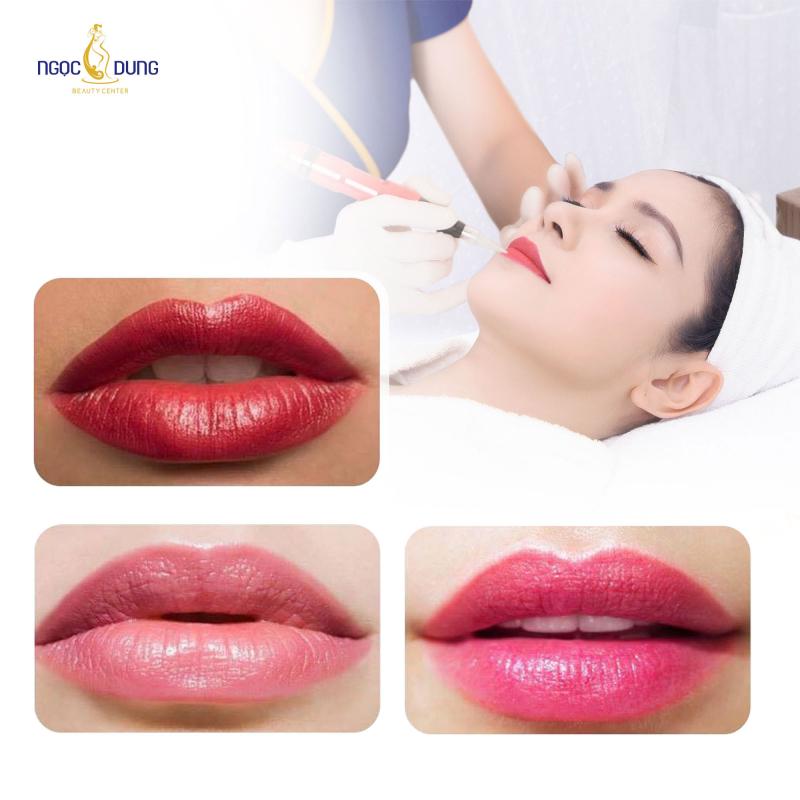 Thẩm Mỹ Viện Ngọc Dung