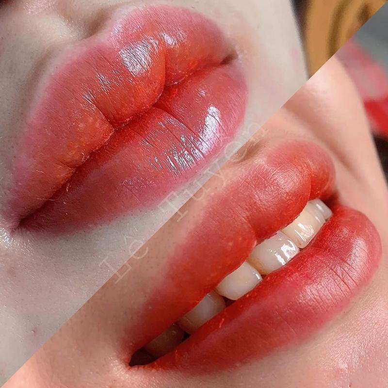 Thẩm Mỹ Viện Nguyên Nhung