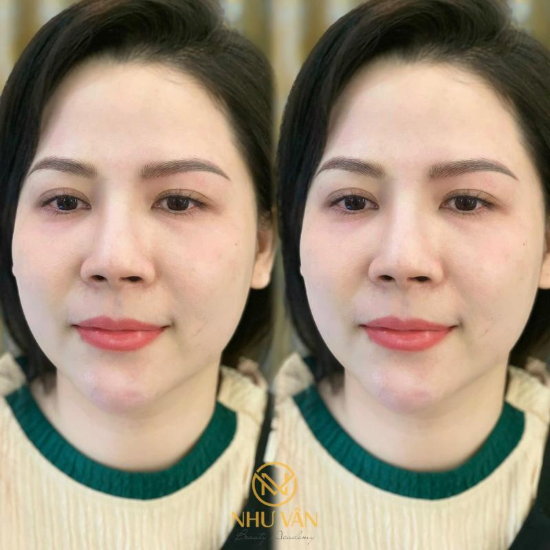 Thẩm Mỹ Viện Như Vân