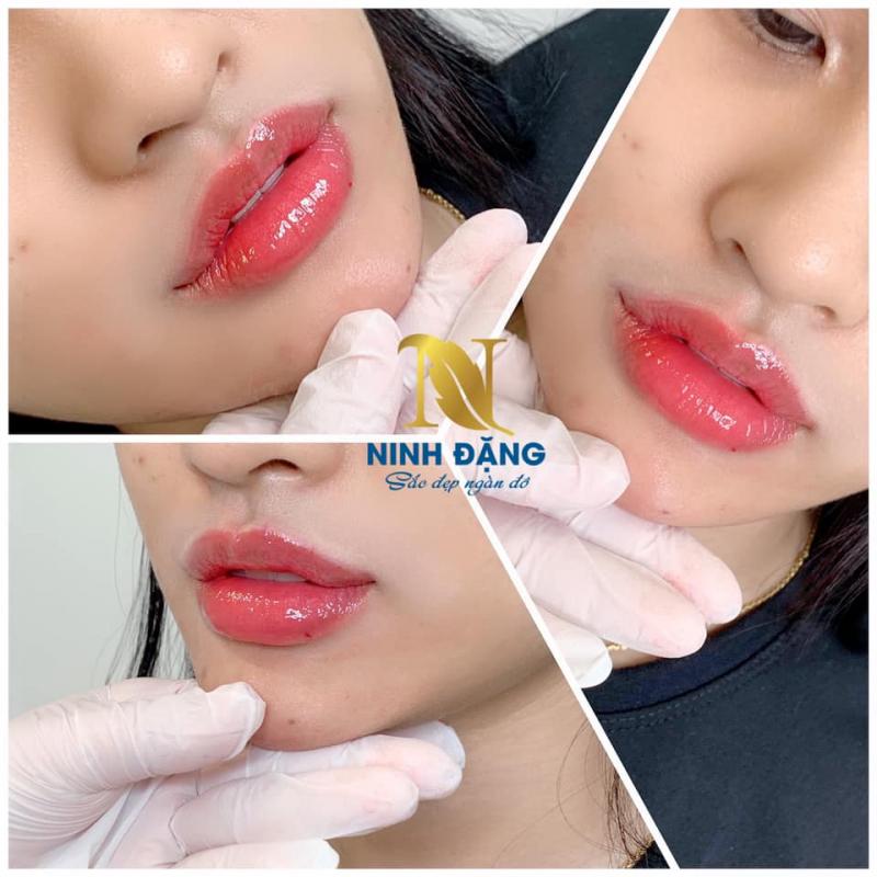 Thẩm mỹ viện Ninh Đặng