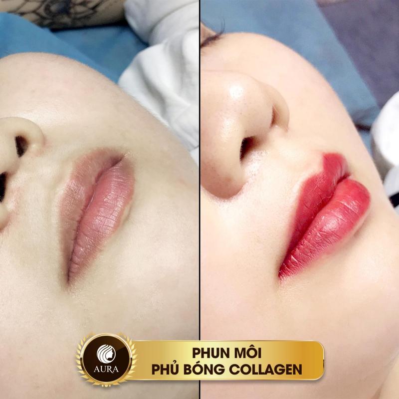 Thẩm Mỹ Viện Quốc Tế Aura