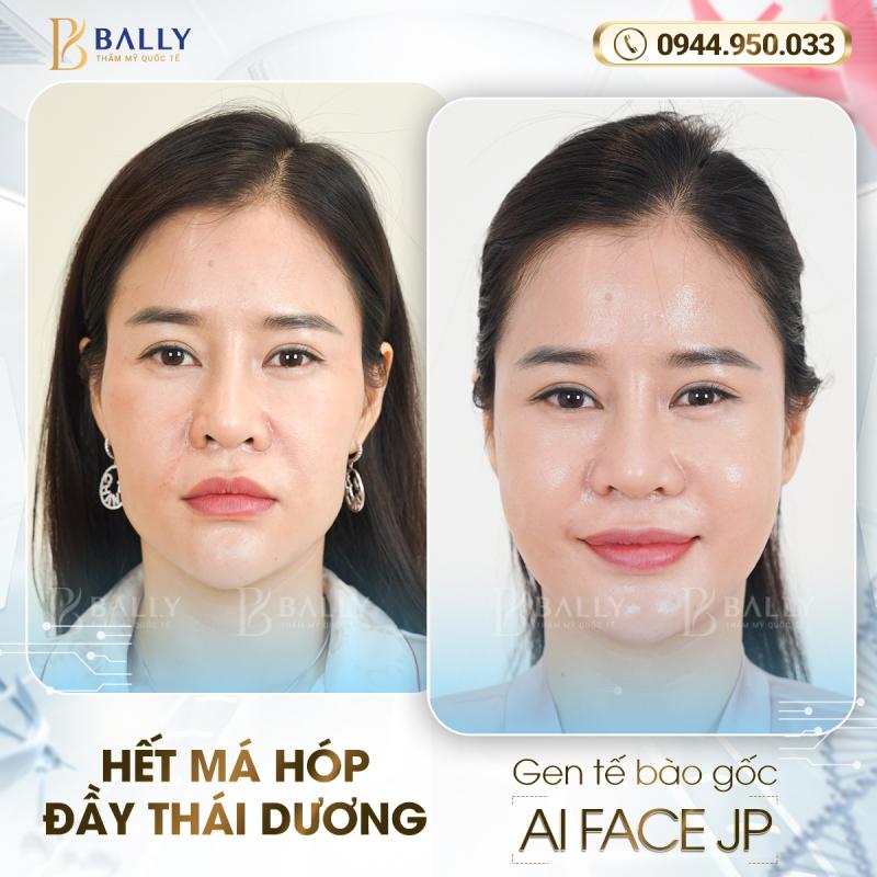 Thẩm mỹ viện quốc tế Bally