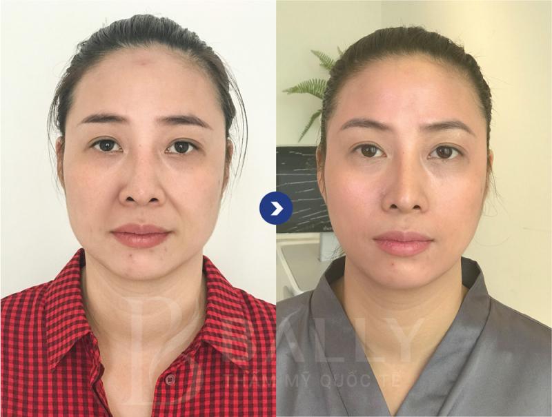 Thẩm mỹ viện Quốc tế Bally