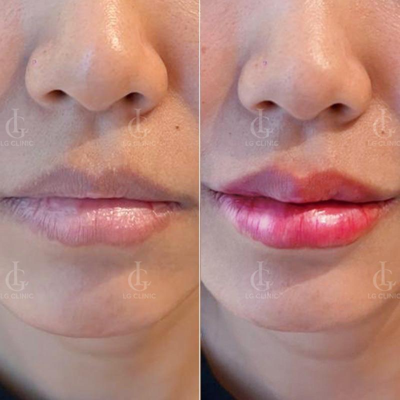 Thẩm Mỹ Viện Quốc Tế Little Garden Spa Tân Phú