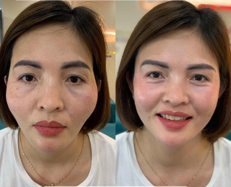 Thẩm Mỹ Viện Quốc Tế Trang Hồng - Thiên Đường Làm Đẹp