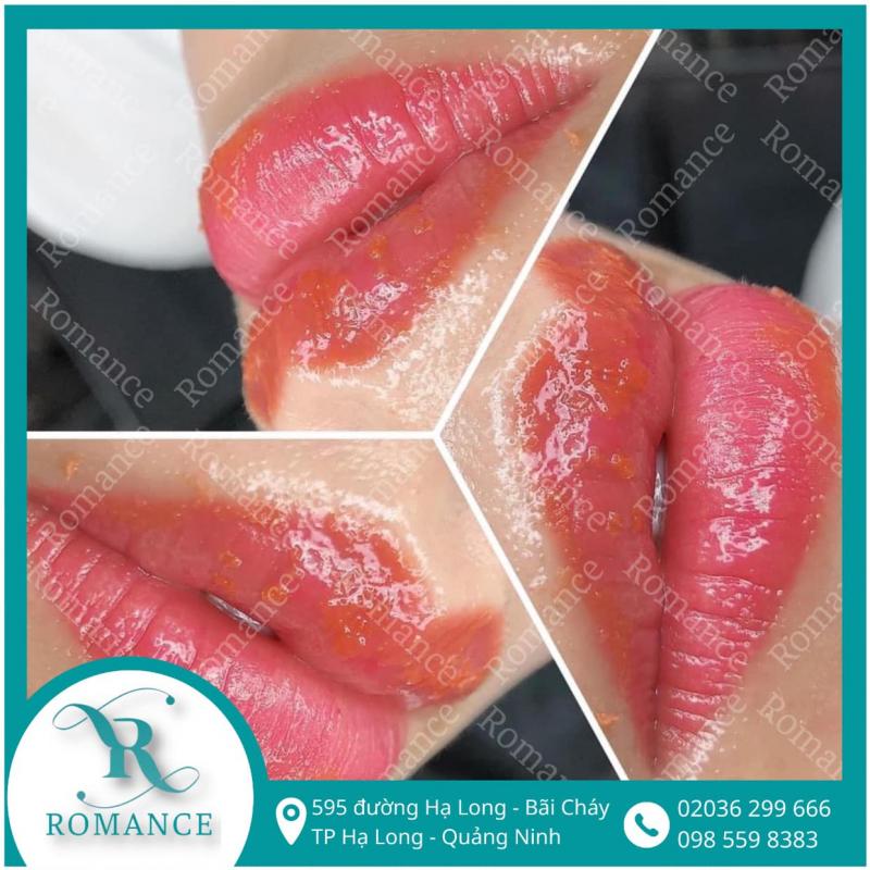 Thẩm Mỹ Viện Romance