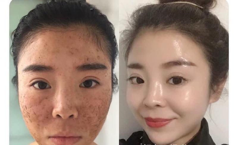 Thẩm mỹ viện Sài Gòn Luxury Hải Dương