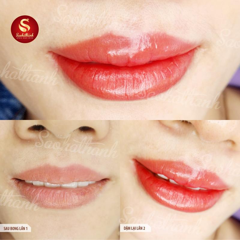 THẨM MỸ VIỆN SAO HÀ THÀNH