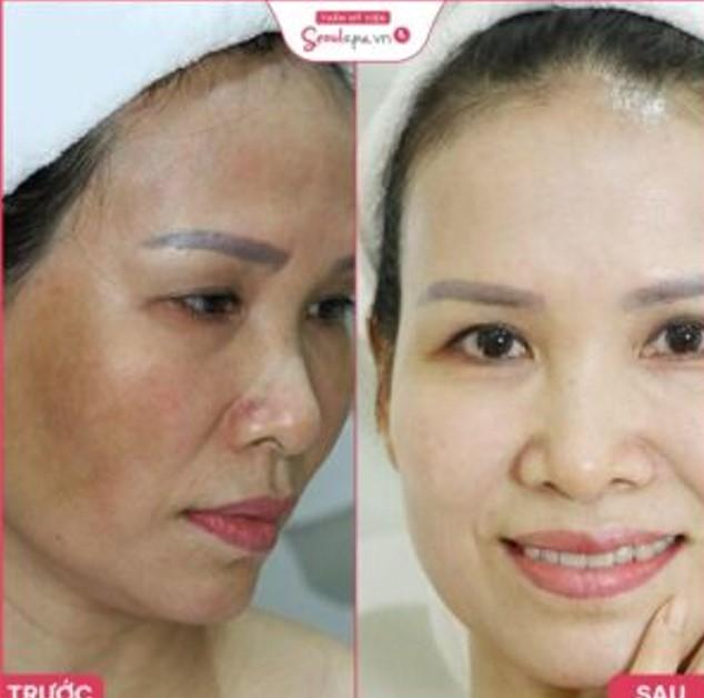 Thẩm Mỹ Viện SeoulSpa Bến Tre