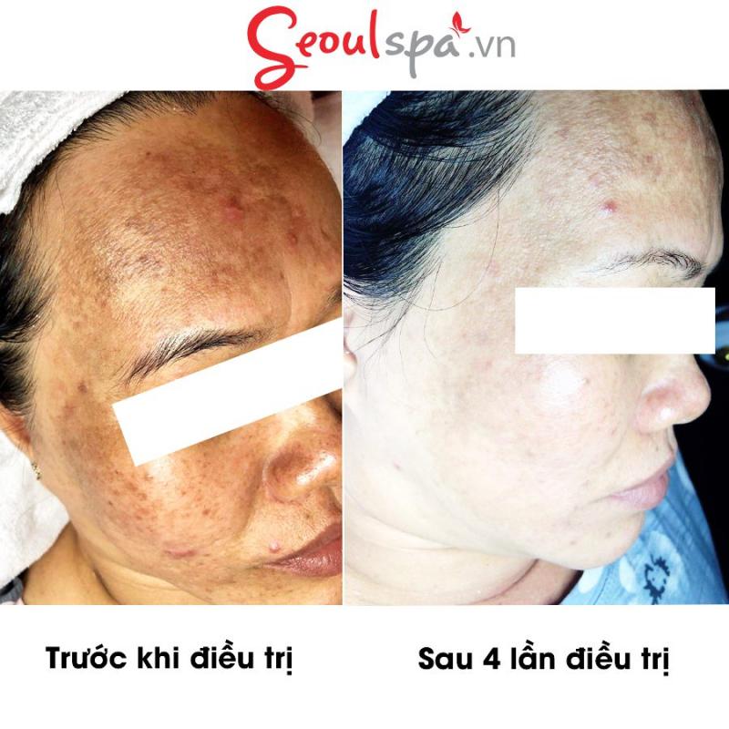 Thẩm Mỹ Viện SeoulSpa.Vn