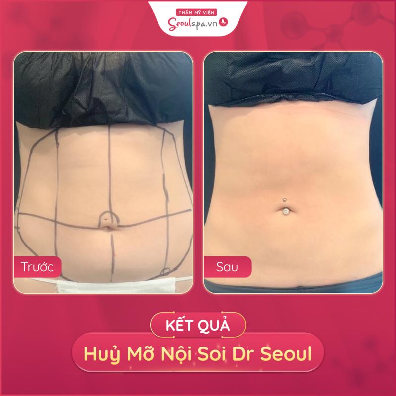 Thẩm Mỹ Viện SeoulSpa.Vn