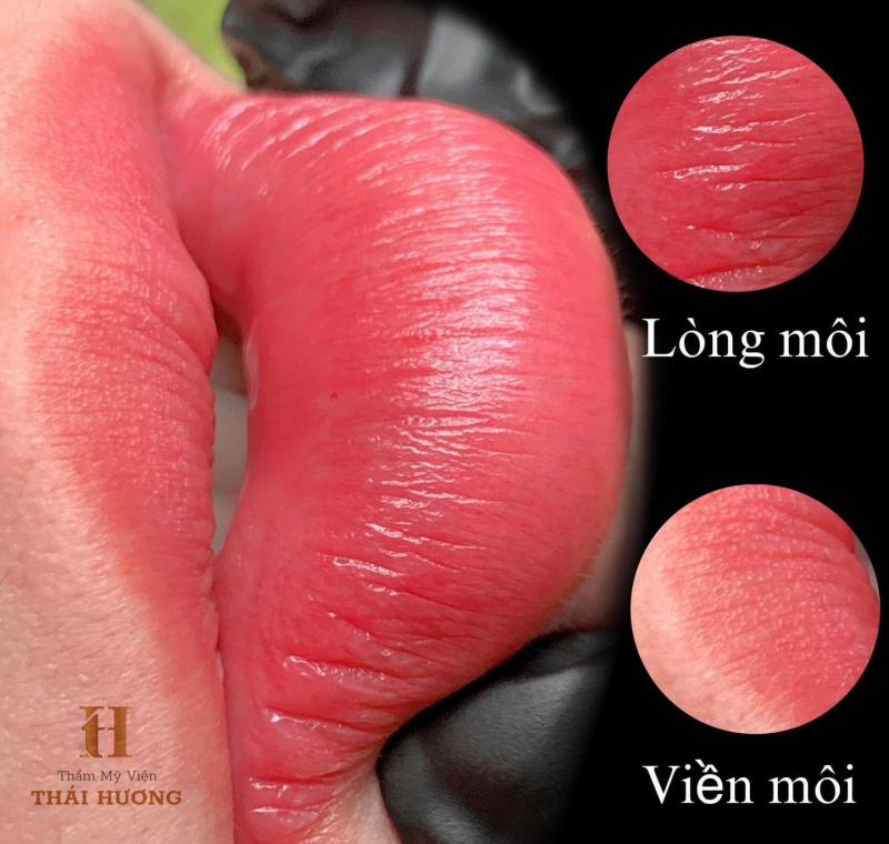 Thẩm Mỹ Viện Thái Hương